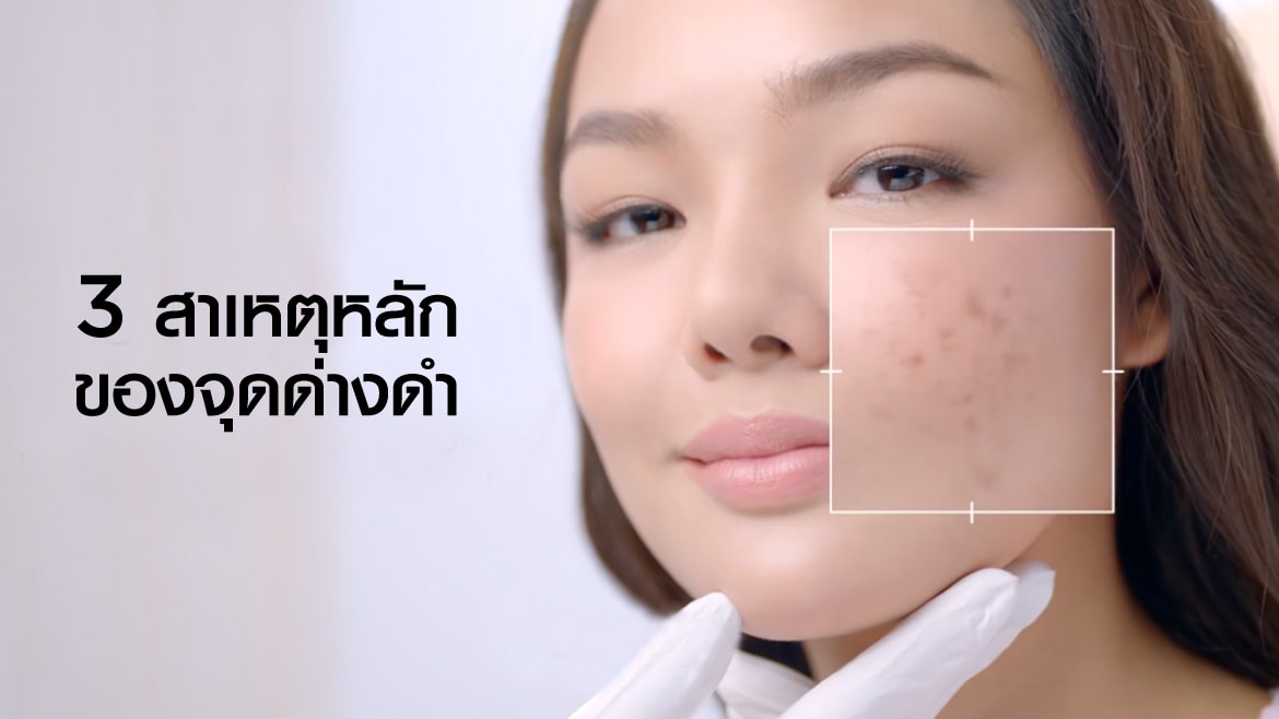 3 สาเหตุหลักของจุดด่างดำ