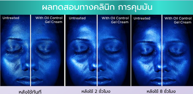 ครีม L'Oreal Paris