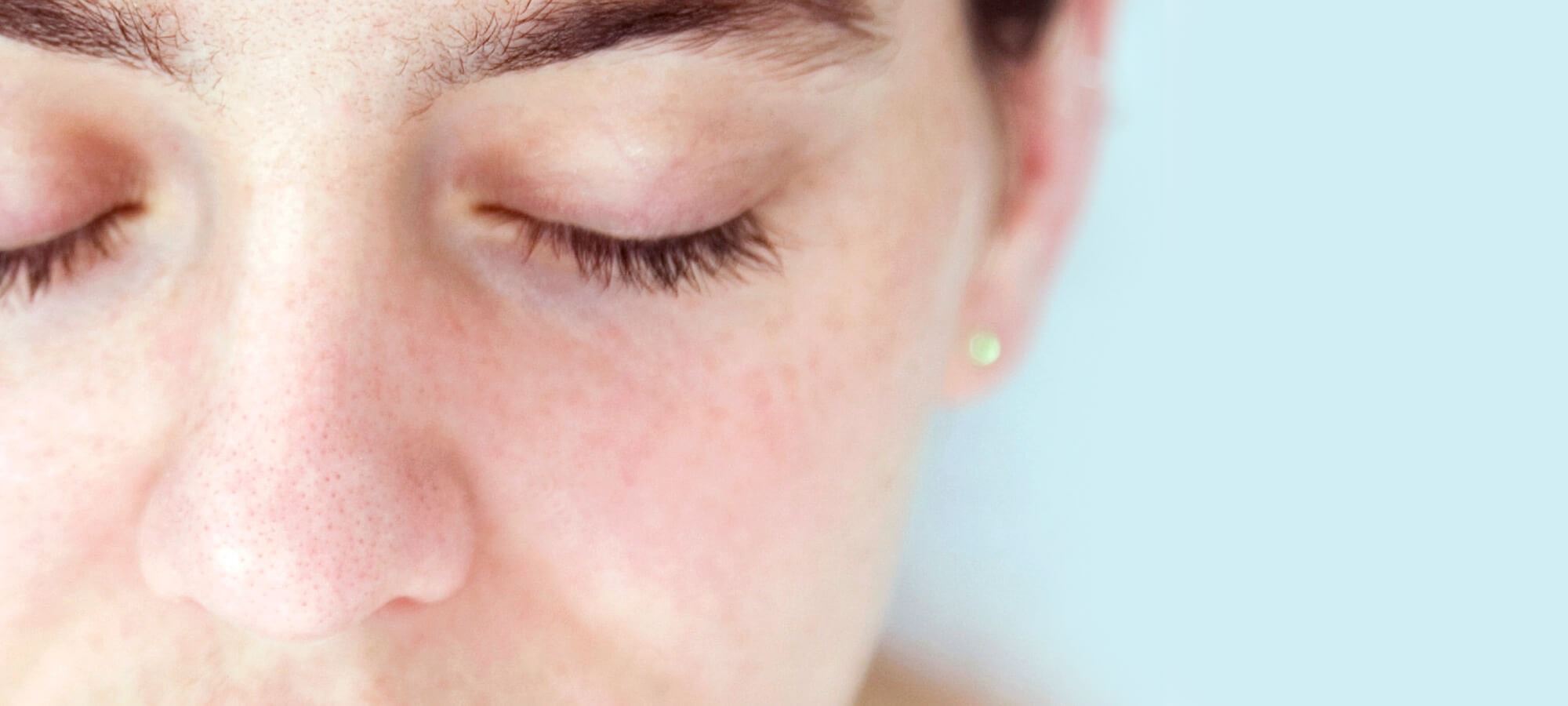 ป้องกันผิวจากแสงแดดไม่ให้ผิวเสีย