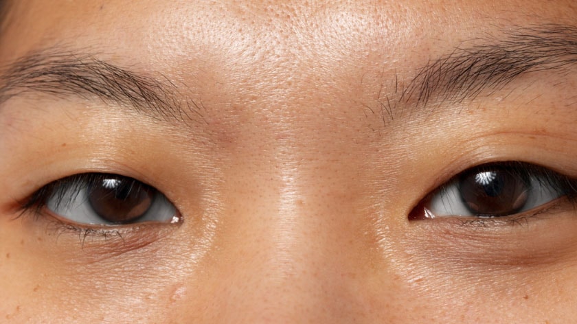 ใต้ตาคล้ำ