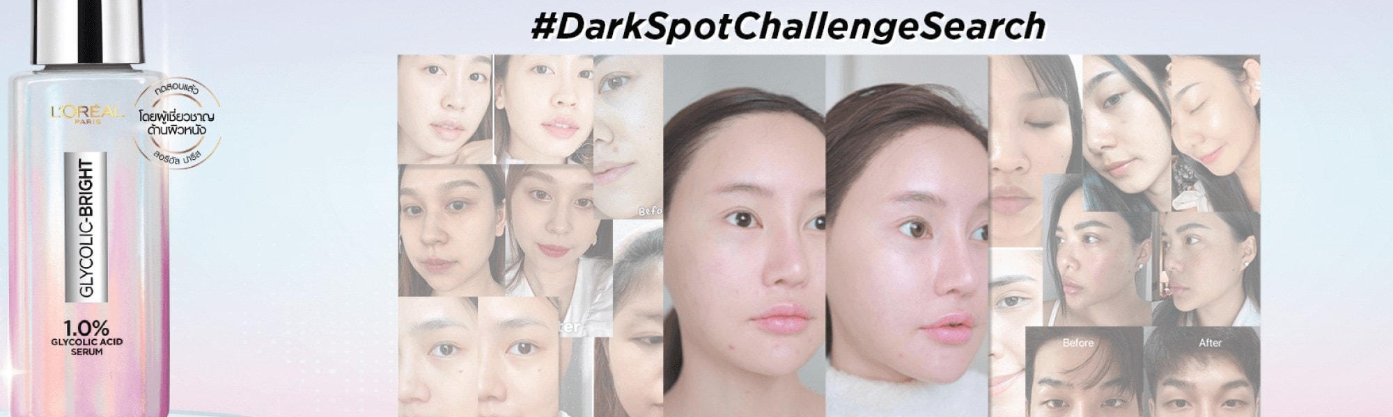 Darkspotchallenge