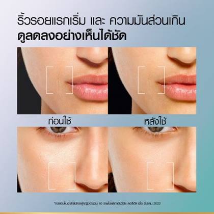 ไฮยาลูรอนิค แอซิด ออยล์ คอนโทรล เจล ครีม